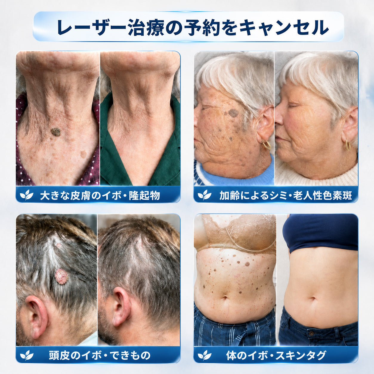 おめでとうございます！ Hiskin®から、あなただけのサプライズアップグレード！   すでに特別オファーをご利用中ですが、さらにお得なチャンスが解放されました。   次回のご購入がなんと50%OFFに！   この限定オファーは、今から2分間だけ有効です！