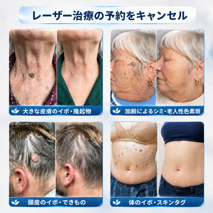 おめでとうございます！ Hiskin®から、あなただけのサプライズアップグレード！   すでに特別オファーをご利用中ですが、さらにお得なチャンスが解放されました。   次回のご購入がなんと50%OFFに！   この限定オファーは、今から2分間だけ有効です！