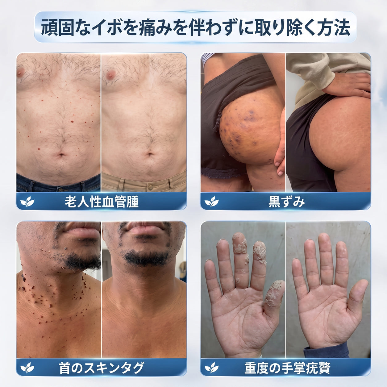 おめでとうございます！ Hiskin®から、あなただけのサプライズアップグレード！   すでに特別オファーをご利用中ですが、さらにお得なチャンスが解放されました。   次回のご購入がなんと50%OFFに！   この限定オファーは、今から2分間だけ有効です！