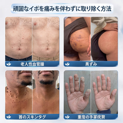 おめでとうございます！ Hiskin®から、あなただけのサプライズアップグレード！   すでに特別オファーをご利用中ですが、さらにお得なチャンスが解放されました。   次回のご購入がなんと50%OFFに！   この限定オファーは、今から2分間だけ有効です！