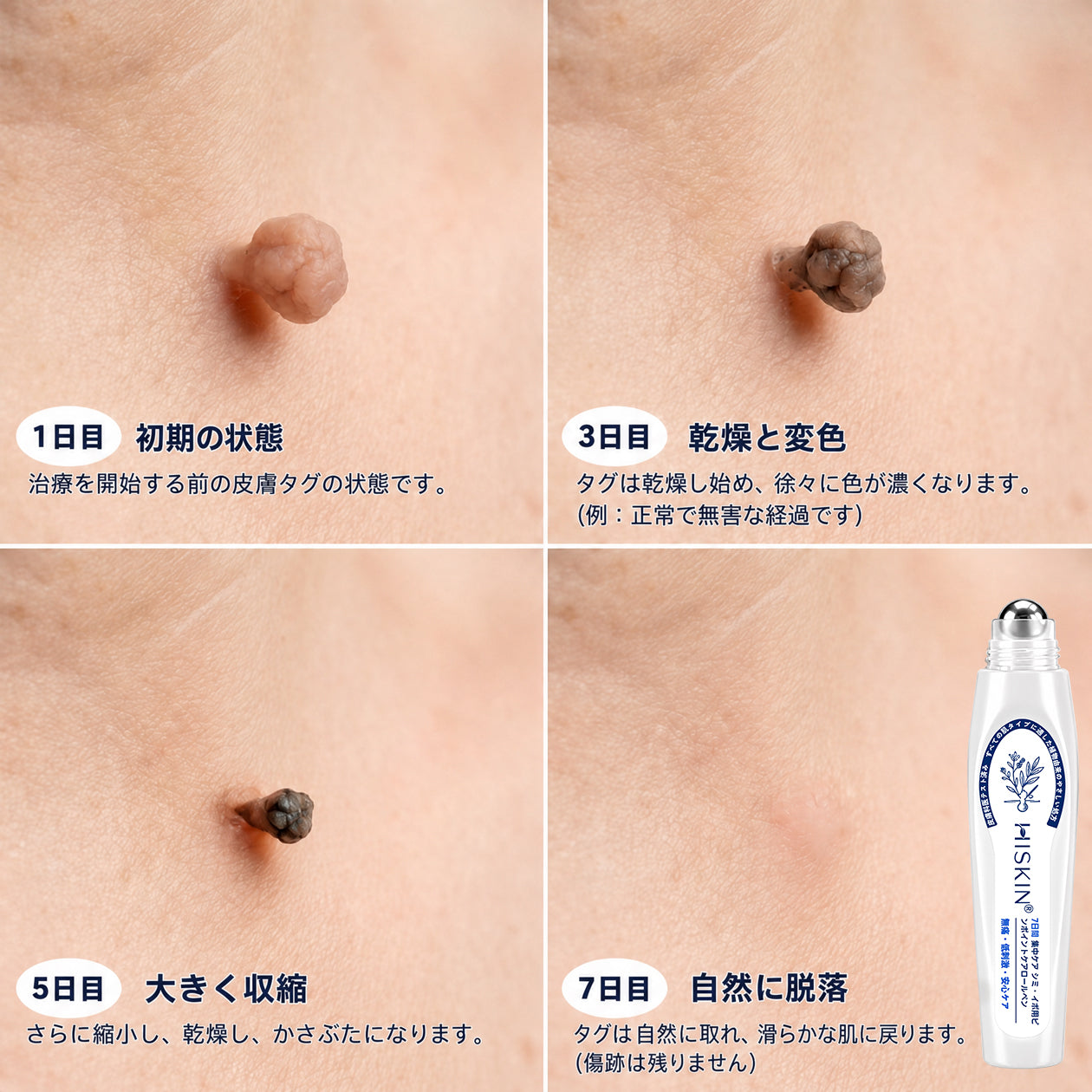 おめでとうございます！ Hiskin®から、あなただけのサプライズアップグレード！   すでに特別オファーをご利用中ですが、さらにお得なチャンスが解放されました。   次回のご購入がなんと50%OFFに！   この限定オファーは、今から2分間だけ有効です！
