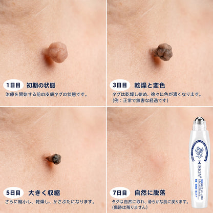 おめでとうございます！ Hiskin®から、あなただけのサプライズアップグレード！   すでに特別オファーをご利用中ですが、さらにお得なチャンスが解放されました。   次回のご購入がなんと50%OFFに！   この限定オファーは、今から2分間だけ有効です！